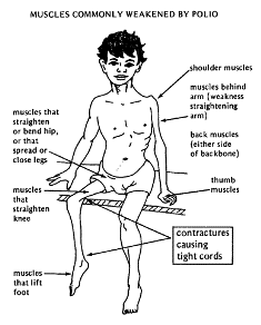 Schema vaccination dt polio