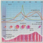 Dysménorrhées et kystes ovariens