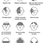 Migraines et céphalées
