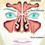Cas clinique infectieux
