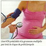 L’accouchement