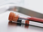 Autres bilans biologiques