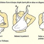 Les traumatismes / fractures