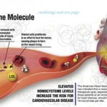 L’homocystéine