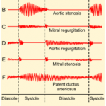 Le système cardiovasculaire : les vaisseaux sanguins (MARIEB ch.19)