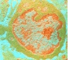 Lympho